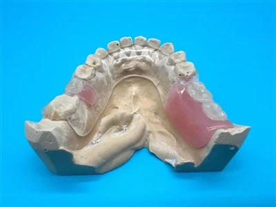 Răng giả khung kim loại trong suốt được đánh bóng